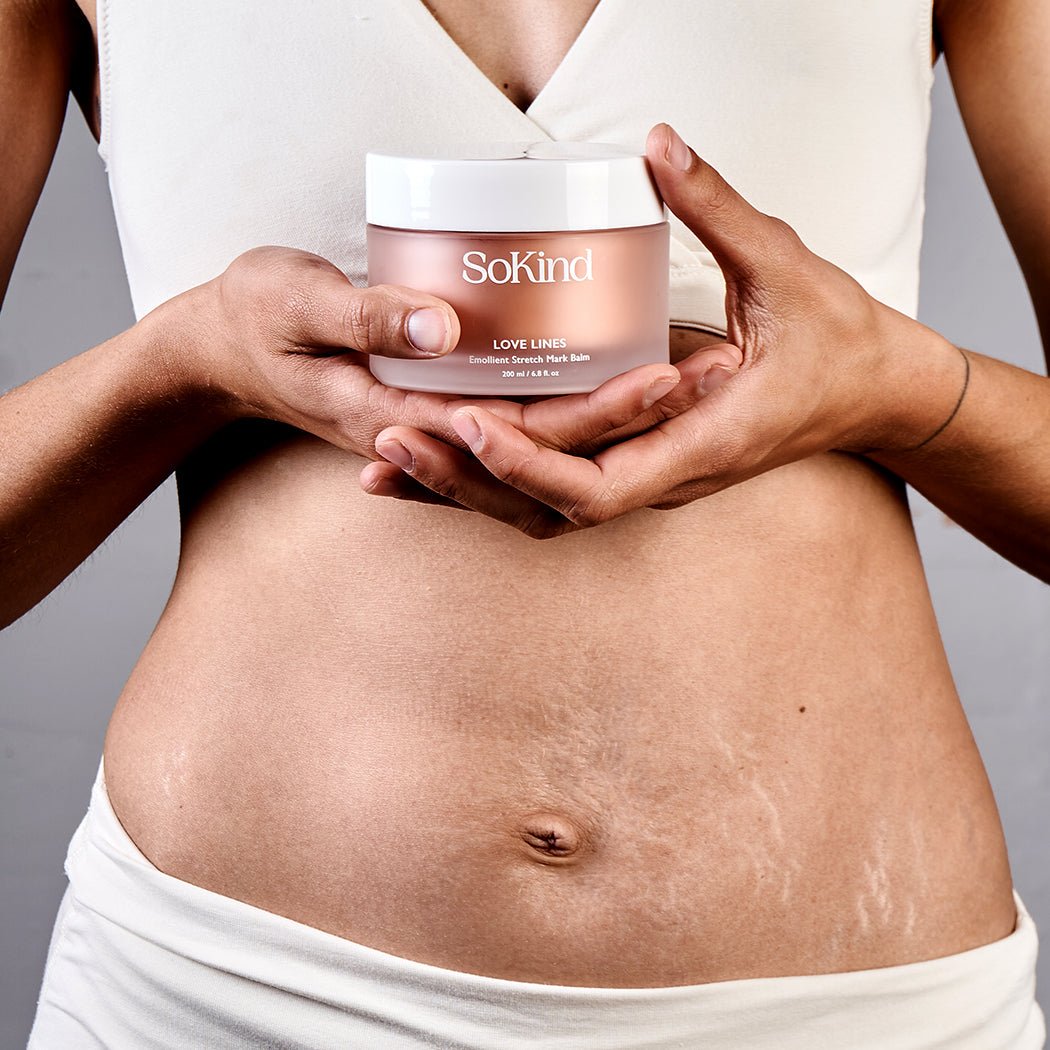 SoKind - Love Lines aktiv strækmærkecreme#SoKindSkincareBuump